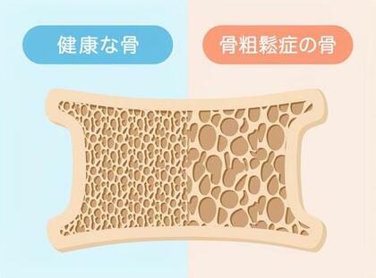 骨トントンで骨の密度を上げていこーーー⬆︎
